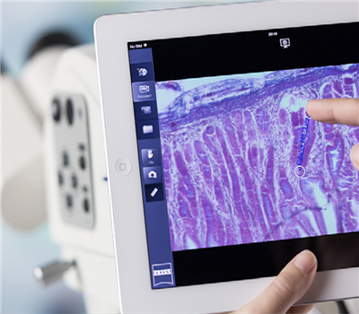 激光扫描共聚焦显微镜的原理和应用2